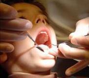 توسعه یونیت‌های دندانپزشکی سیار در مدارس