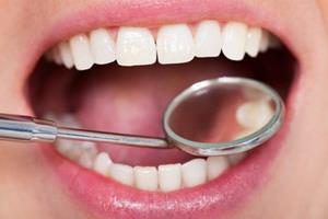 دندان‌ها کمبود ویتامین D را نشان می‌دهند