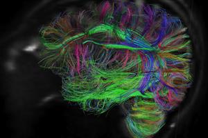 کشف مدارهای مغزی مرتبط با اختلال اضطراب