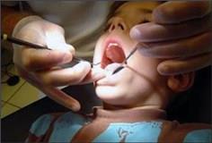 خدمات بهداشت دهان ودندان رایگان به ابتدایی ها