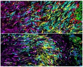 تصاویر رنگارنگ از میکروب‌های دندان 