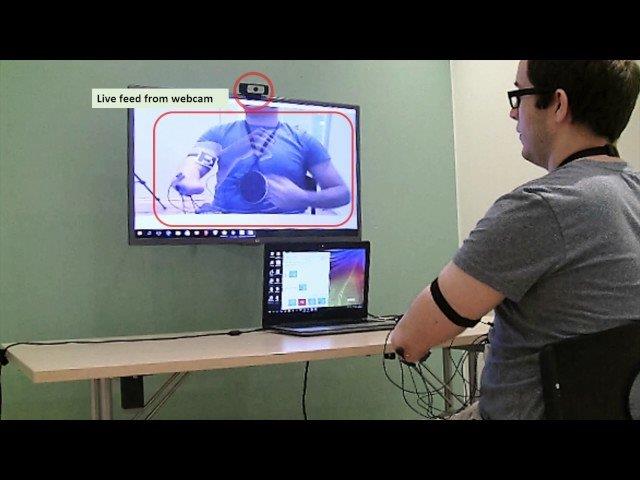 کاهش درد اندام خیالی بوسیله بازی رایانه‌ای