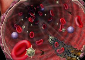 حذف آسان نانوذرات از خون با رویکرد جدید 