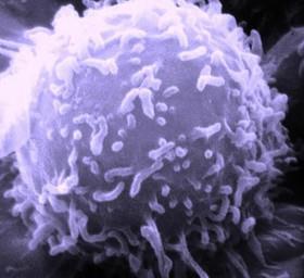 نانوحاملی با پوشش پپتیدی برای توقف رشد تومور 