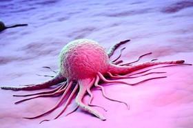 نتایج موفقیت‌آمیز مطالعات محققان ایرانی برای درمان سه نوع سرطان 