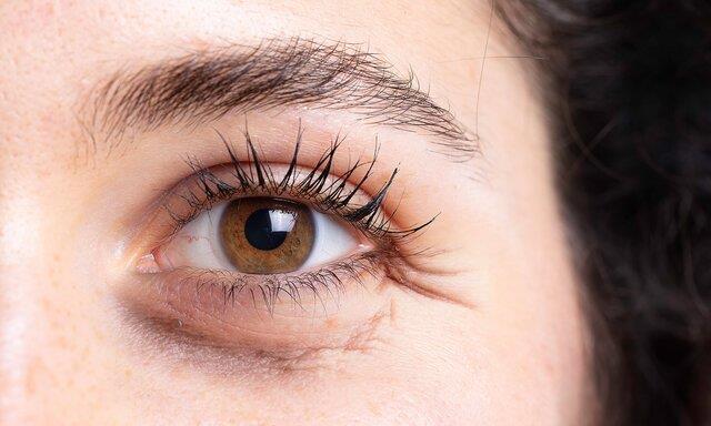  تعیین سن زیستی با اسکنر چشم