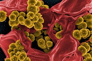 از بین بردن میکروب‌های قوی بدون آنتی‌بیوتیک