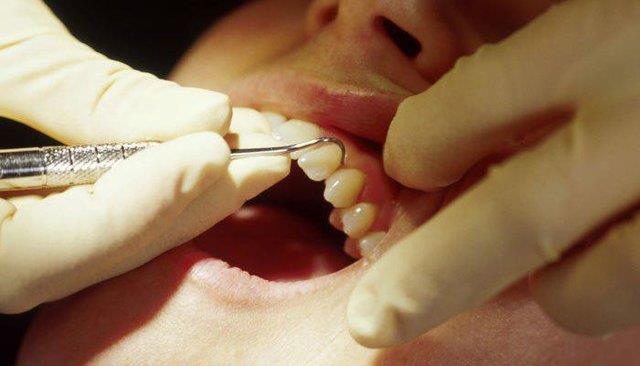  ابداع یک ماده هوشمند برای پرکردن دندان