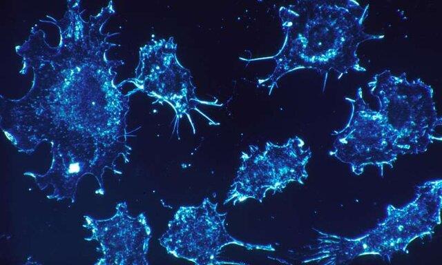 ابداع روش جدید درمان سرطان که می‌تواند جایگزین شیمی‌ درمانی باشد