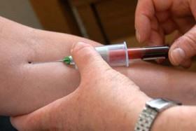   آزمایش خون جدید برای تشخیص سرطان پوست