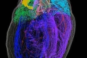  نخستین نقشه ۳بعدی از نورون‌های قلب ارائه شد