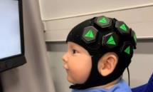 ابداع کلاهی برای بررسی مغز نوزادان