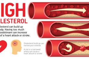 اختلال کلسترول ژنتیکی خطر بیماری‌های قلبی را افزایش می‌دهد