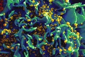 درمان ایدز با آنتی بادی‌های سرطان