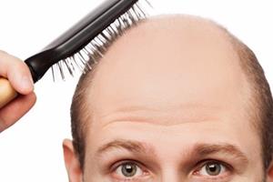 شناسایی علت سفید شدن و ریختن موها