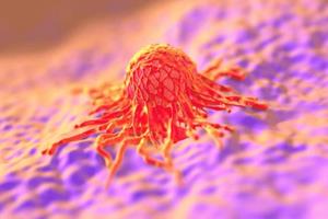 پیش‌بینی تاثیر شیمی‌درمانی روی تومورهای سرطانی 