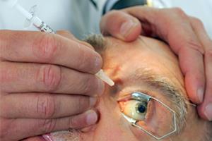 تشخیص احتمال نابینایی با آزمایش خون