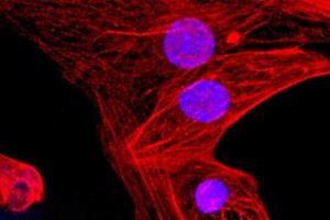 جلوگیری از رد پیوند سلول‌های بنیادی با کمک اصلاح ژن کریسپر