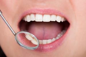 ارتباط مستقیم بیماری دهانی "پیوره" با فشار خون بالا
