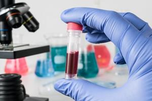 تشخیص انواع سرطان با آزمایش خون ممکن می‌شود