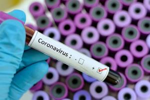  تشخیص "کروناویروس" در کمتر از ۱۵ دقیقه