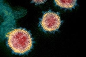  کروناویروس چگونه سلول‌های انسان را آلوده می‌کند؟