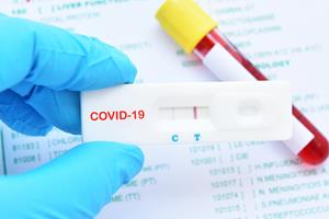  تایید یک آزمایش سریع "کووید-۱۹" توسط وزارت بهداشت کانادا