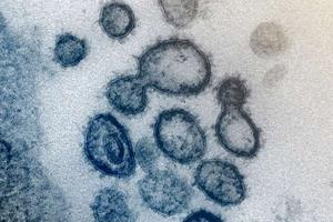شناسایی پروتئین اصلی کروناویروس با کمک نوعی آزمایش پادتن