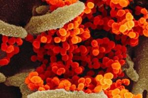  آسیب‌پذیرترین سلول‌های انسان در مقابل کروناویروس شناسایی شدند