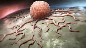 کشف پروتئینی که ترمز سرطان خون است 
