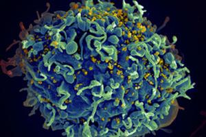 درمان کامل HIV با روش «شوک و کشتن» 