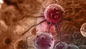 از بین بردن سلول‌های بنیادی سرطان با نانوذرات 