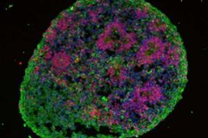 رشد دادن مینی‌مغز از سلول‌های پوستی بیماران اوتیسمی 