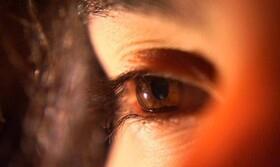 راهکار محقق ایرانی برای بهبود اختلال بینایی با نور فروسرخ