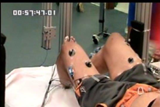 درمان بیماران فلج کامل با تحریک الکتریکی نخاع