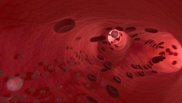 آنتی‌اکسیدان‌ها عروق خونی را 20 سال جوان می‌کنند