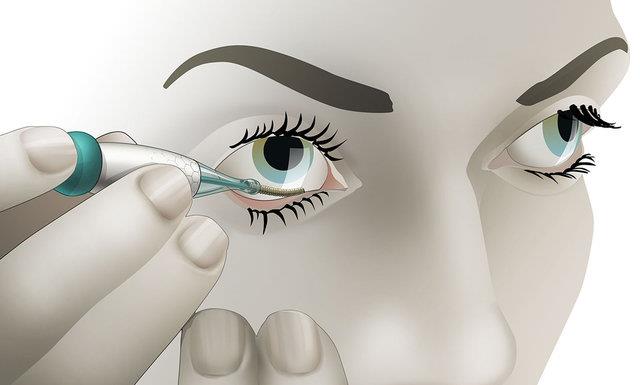  ابداع حسگر چشمی اندازه‌گیری گلوکز توسط استارتاپ هلندی