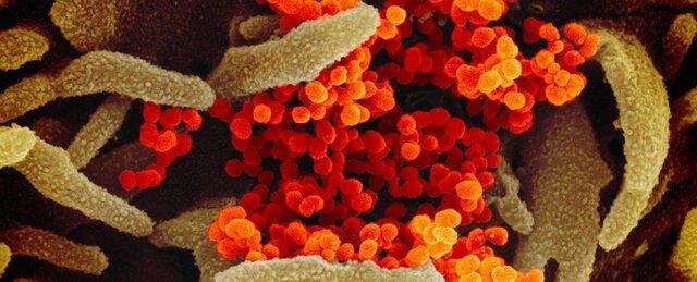  آسیب‌پذیرترین سلول‌های انسان در مقابل کروناویروس شناسایی شدند