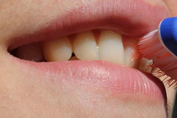  کشف ارتباط بین باکتری‌های دهانی و اختلالات روده