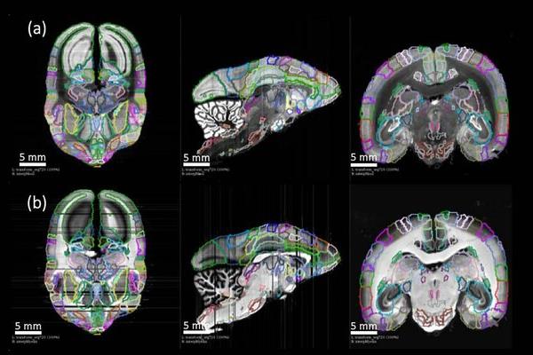 درک اتصالات نورونی با نقشه‌برداری از مغز میمون