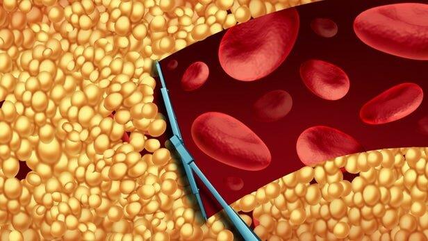  توسعه داروی بدون عوارض برای کاهش کلسترول خون