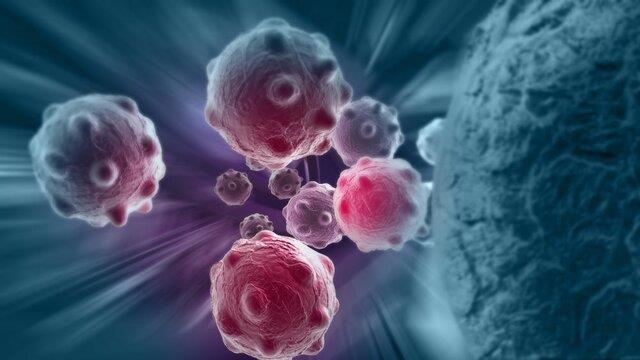  روشی نوین برای نابودی سلول‌های سرطانی با کمک نانوذرات