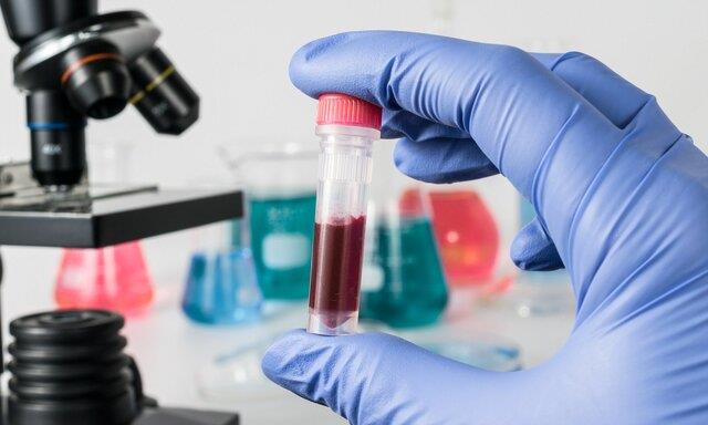 تشخیص انواع سرطان با آزمایش خون ممکن می‌شود