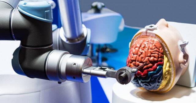  نخستین جراحی "آنوریسم مغزی" توسط ربات انجام شد