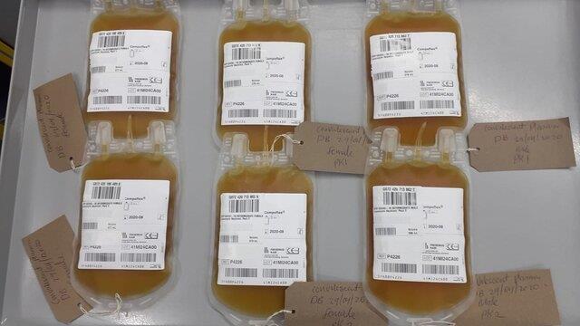 تزریق پلاسمای خون نجات یافتگان کرونا به بیماران کرونایی
