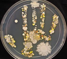تصاویری جالب از میکروب‌های کف دست کودک یک میکروب‌شناس 