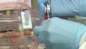 تلاش برای درمان سرطان خون با نانوحامل‌های هوشمند توسط محققان ایرانی 